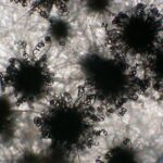 Chaetomium mold under a microscope